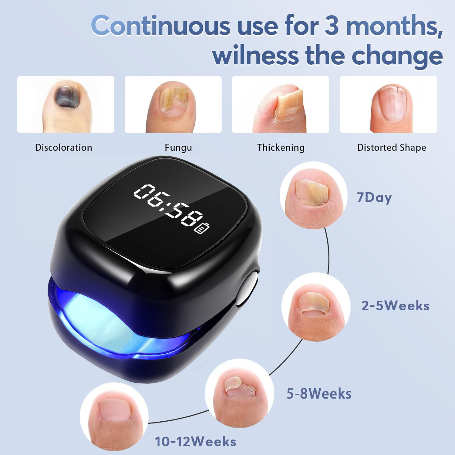 Dispositivo Laser UV Professio - Industrial Laser Removal recensione e prezzo